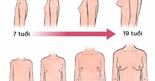Sự thay đổi ở vùng ngực và hông chính là một trong những dấu hiệu dậy thì ở bé gái