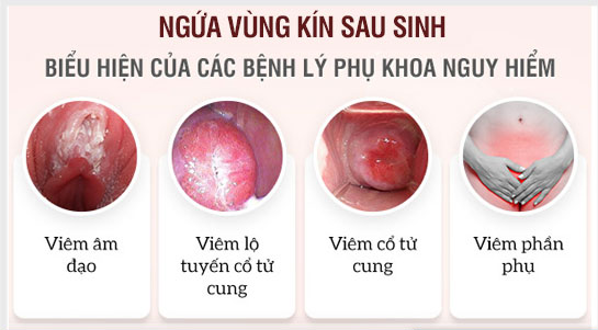 Sau Sinh Vùng Kín Bị Ngứa: Nguyên Nhân và Cách Khắc Phục Hiệu Quả