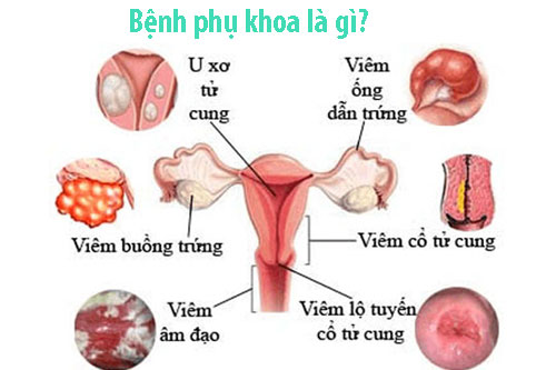 Những nguyên nhân khác có thể dẫn đến bệnh phụ khoa