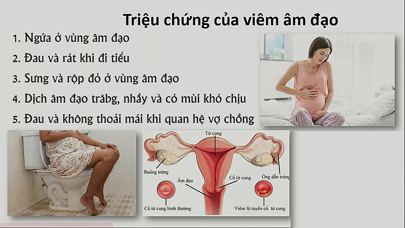 Những thói quen hằng ngày cũng ảnh hưởng đến sức khỏe phụ khoa