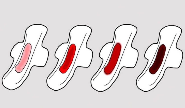 Màu Sắc Của Kinh Nguyệt Phản Ánh Gì Về Sức Khỏe Phụ Khoa (P2)