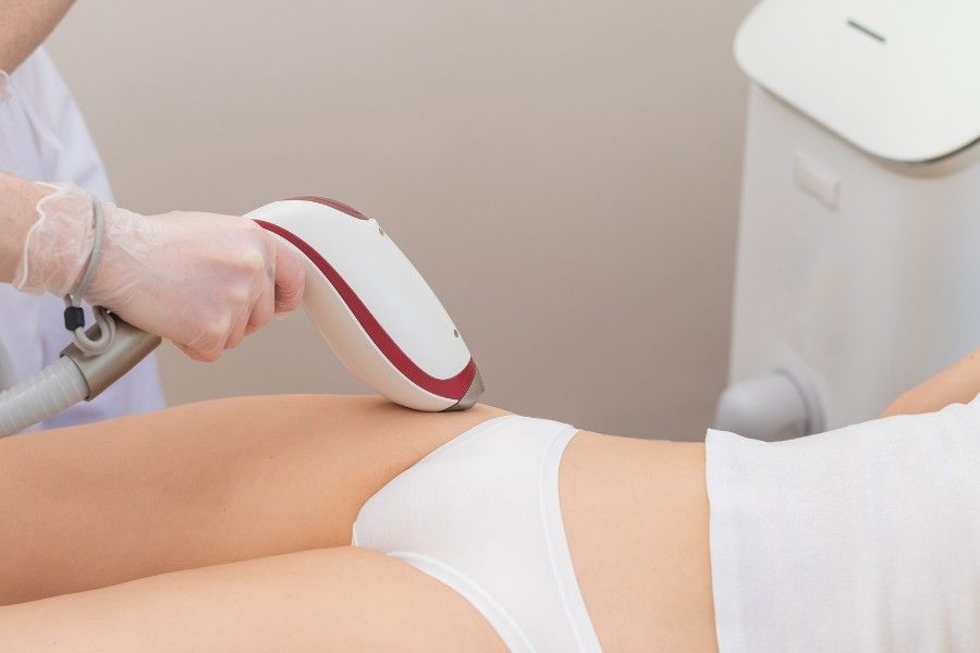 Những Lưu Ý Sau Khi Triệt Lông Vùng Kín (Phần 2)