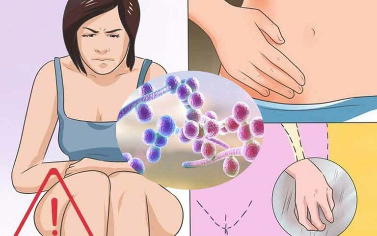 Nên Làm Sau Quan Hệ Để Hạn Chế Nhiễm Nấm Candida (Phần 2)